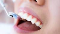 Gum Disease Treatment