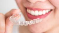 Clear Aligners