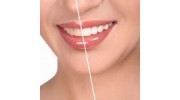 Tooth Whitening