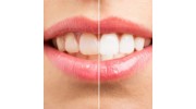 Cosmetic Dentistry