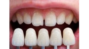 Veneers By Natural Smiles