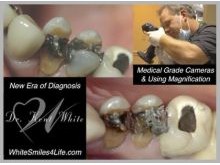 New Era of Dental Care Diagnosis, Beyond Silver Fillings