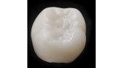 Dental Crowns