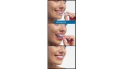 Invisalign