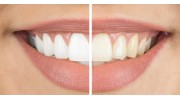 Cosmetic Dentistry