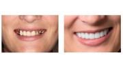 Cosmetic Dentistry