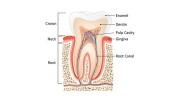 Root Canal Therapy